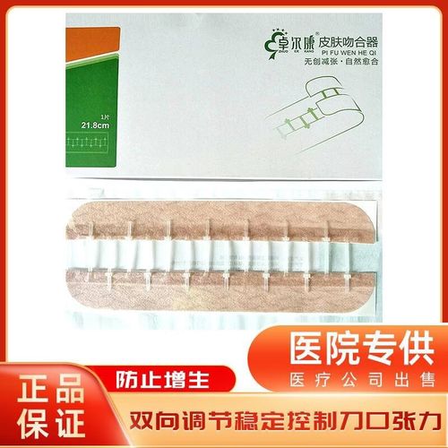 陌驻颜九院减张器皮肤吻合器21.8cm疤痕减张器儿童术后伤口减张器 21